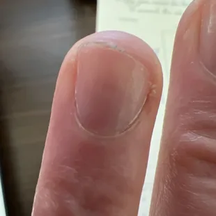 Nov. 2024 over a month of dealing with ring finger split, down the middle, I had to cut it down. This is a week of growth and oiling