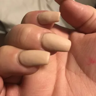 Bumpy texture in the polish