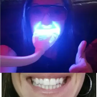 Professional Teeth Whitening. Only $59 with a service.