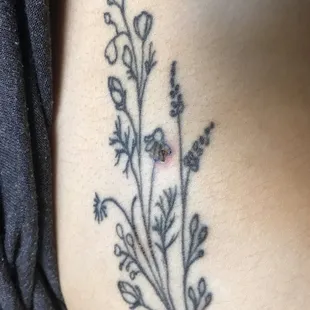 Part of the tattoo damage that later fell off and left a blank spot