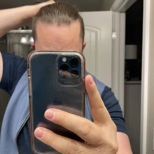 Sorry it's a bit out of focus. See how my left side (near temple) is much higher than the trim on my right side.