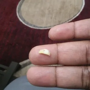 This is the fingernail/toenail in my food from New China Chef. Disgusting!