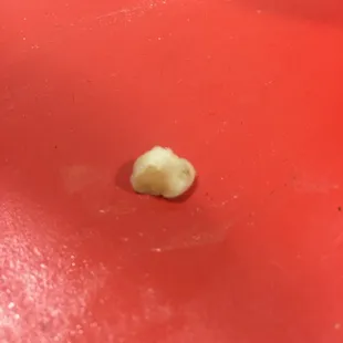 This is a human baby tooth that was in my dinner last week. Disgusting! There is no excuse for this. Disgusting business practices.