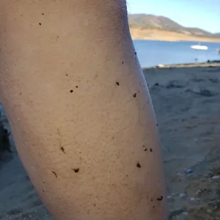 That is not mud. Those are tiny leaches!