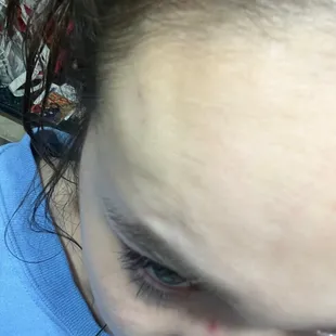 The bruise/bump on my face from their security repeatedly punching me in the head