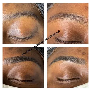 Microblading done by Masterbrow Nisha