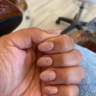 Look at the thumb is awful