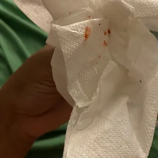 Hair that came out of the cake. My cake was red velvet