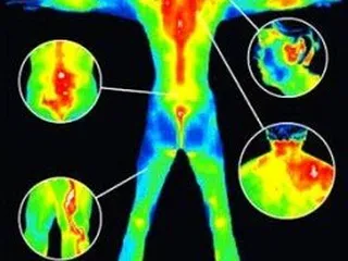 BRAS Thermography