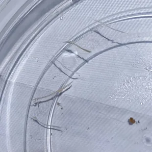 Fish bones in my poke bowl