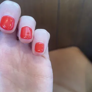 Extremely short nails, very painful