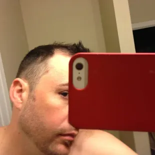 Uneven fade along with the painful nick I was given without apology. No, I don't have any scars on my head. Should be no holes.