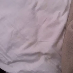 Stains all over the sheets. This is just ONE of them.