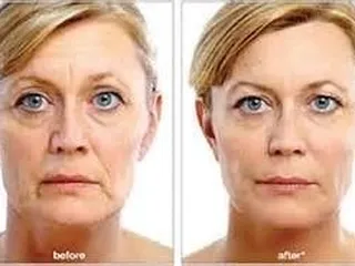 SkinRN Aesthetics