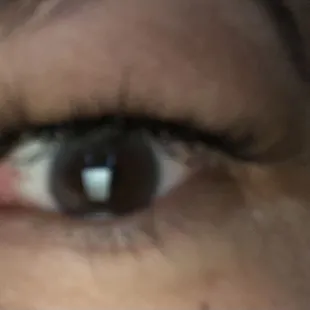 The other uneven sloppy side