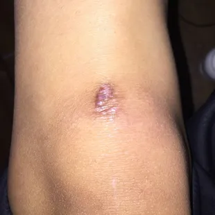 so happy to have this on my body for the rest of my life as a constant reminder of the greatest landlord in the world!!