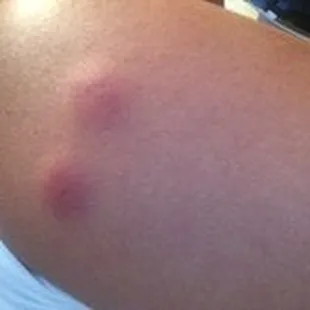 These where the roach bits I was telling you about my husband and my kids got some bit here a pic what a look like