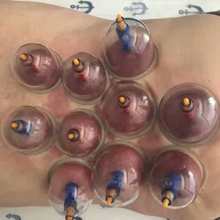 For cupping massage