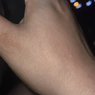 Scratch from security guard