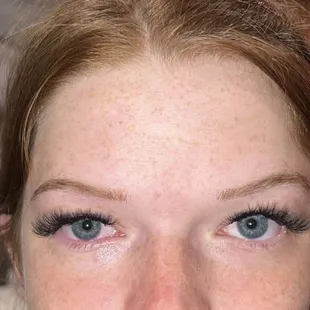 excuse my red eye. it wouldn't stop watering at the end but no pain.