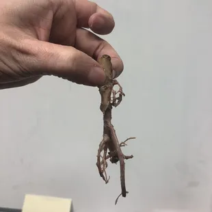 Arterial mass?