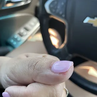 Skin under my thumb nail exposed