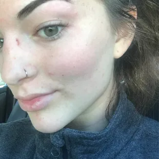 Excuse the scratch on my nose, but my eyebrows are looking good!