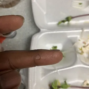 A cooks hair was in my pho (Left finger) ,My hair right thumb!!!