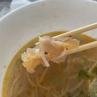 Soft tendon.