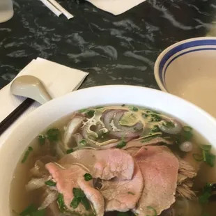 Pho Dac Biet