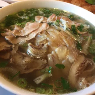 N1. PCD Special Pho