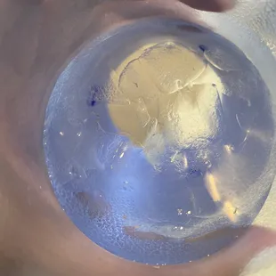 Literal bugs in my water. Zoom in