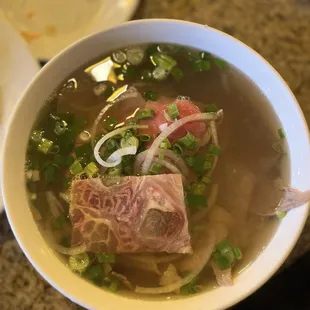 Tendon pho