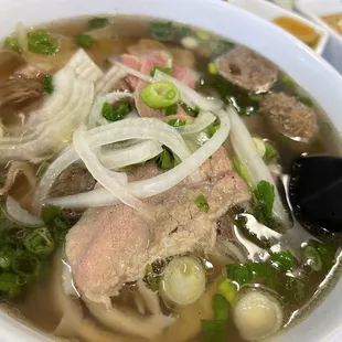 Pho Dac Biet