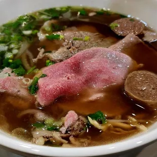 Pho combo ( medium)
