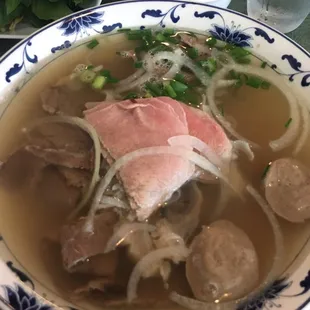 Pho Dac Biet