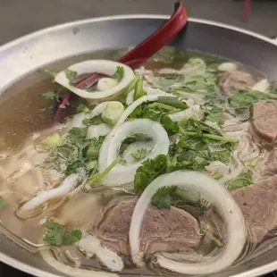 noodle dish, food, noodles, ramen, ramen and noodles, noodle soup