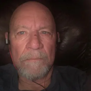 One week post injury.