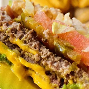 Hamburger Combo