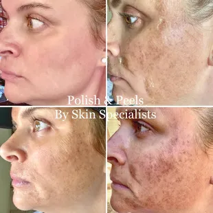 10 days 10 yrs younger !