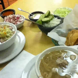 Pozole Surtido