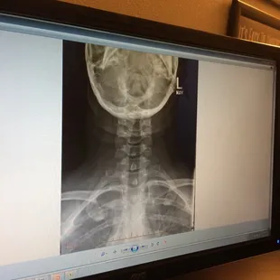 X-ray for evaluation