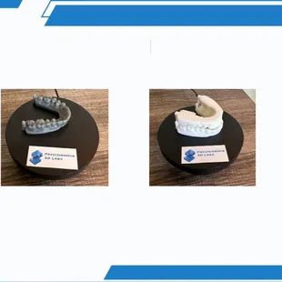 3D printing services using SLA technology for dental