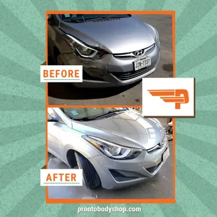 Before and After pictures of this Hyundai that was involved in a collision.