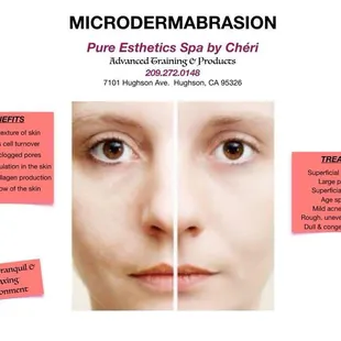 Microdermabrasion-Regular Or Organic