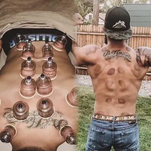 Try our advanced services, such as cupping or hot stones for an added element of relief.