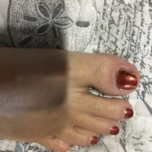 Toe nails