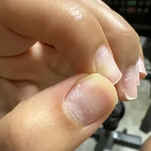 green fungus on my nail