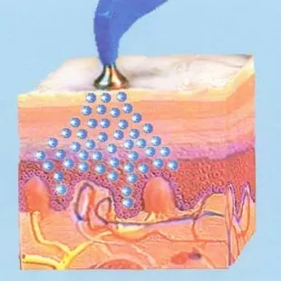 OxyJet Facials