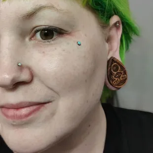Dermal anchor